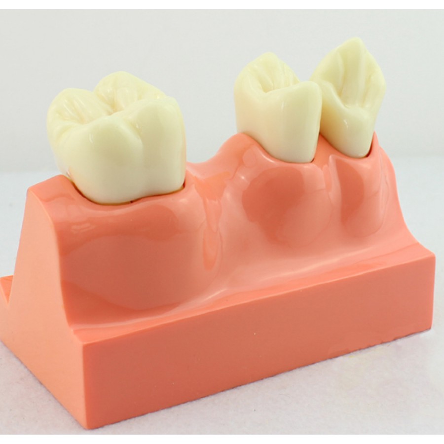 ENOVO®解剖学的歯模型