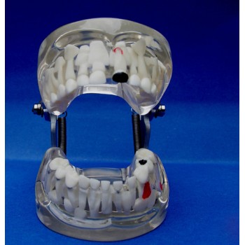 ENOVO®乳歯から永久歯に生え変わる時期の透明模型