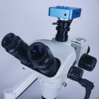 歯科手術用根管治療顕微鏡 カメラ付き デンタルチェアーに適用