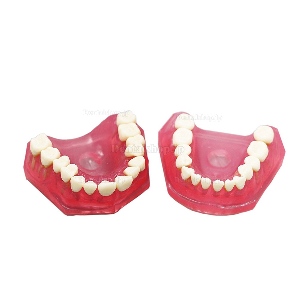 歯科研究治療説明用上下顎義歯模型 高品質脱着可能歯列模型 実用的 クリアベース ピンク