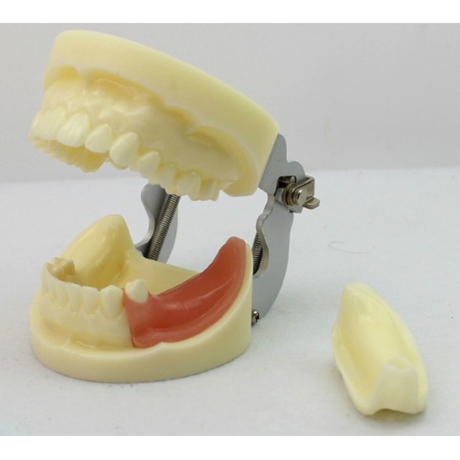 ENOVO®歯科口腔外科インプラント実習用模型
