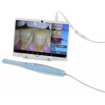 Magenta®歯科用口腔内カメラCF-688A (USB&OTG)