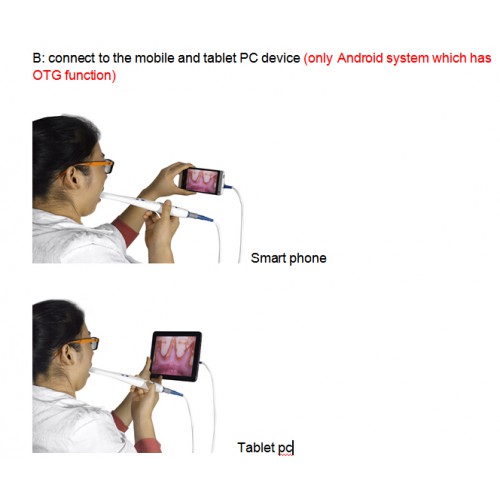 Magenta®歯科用口腔内カメラCF-688A (USB&OTG)