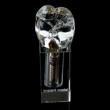 歯科インプラントM2019-II展示用透明模型