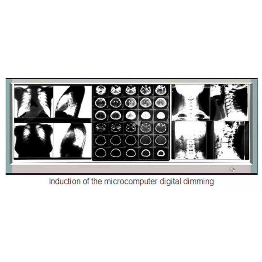 超薄型X線フィルムビューア医療診断LED照明フィルム観察箱1100H