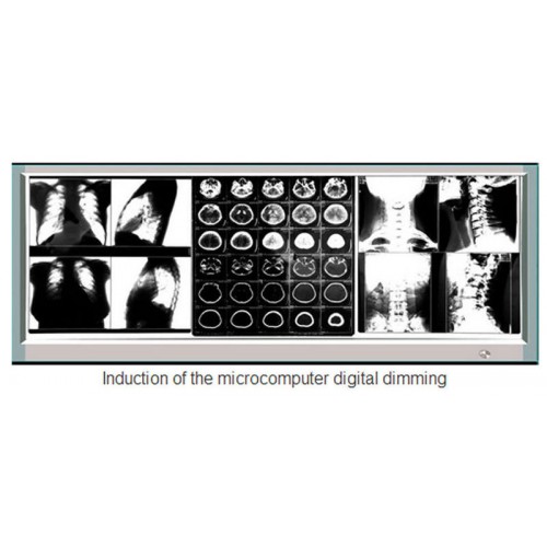 超薄型X線フィルムビューア医療診断LED照明フィルム観察箱1100H