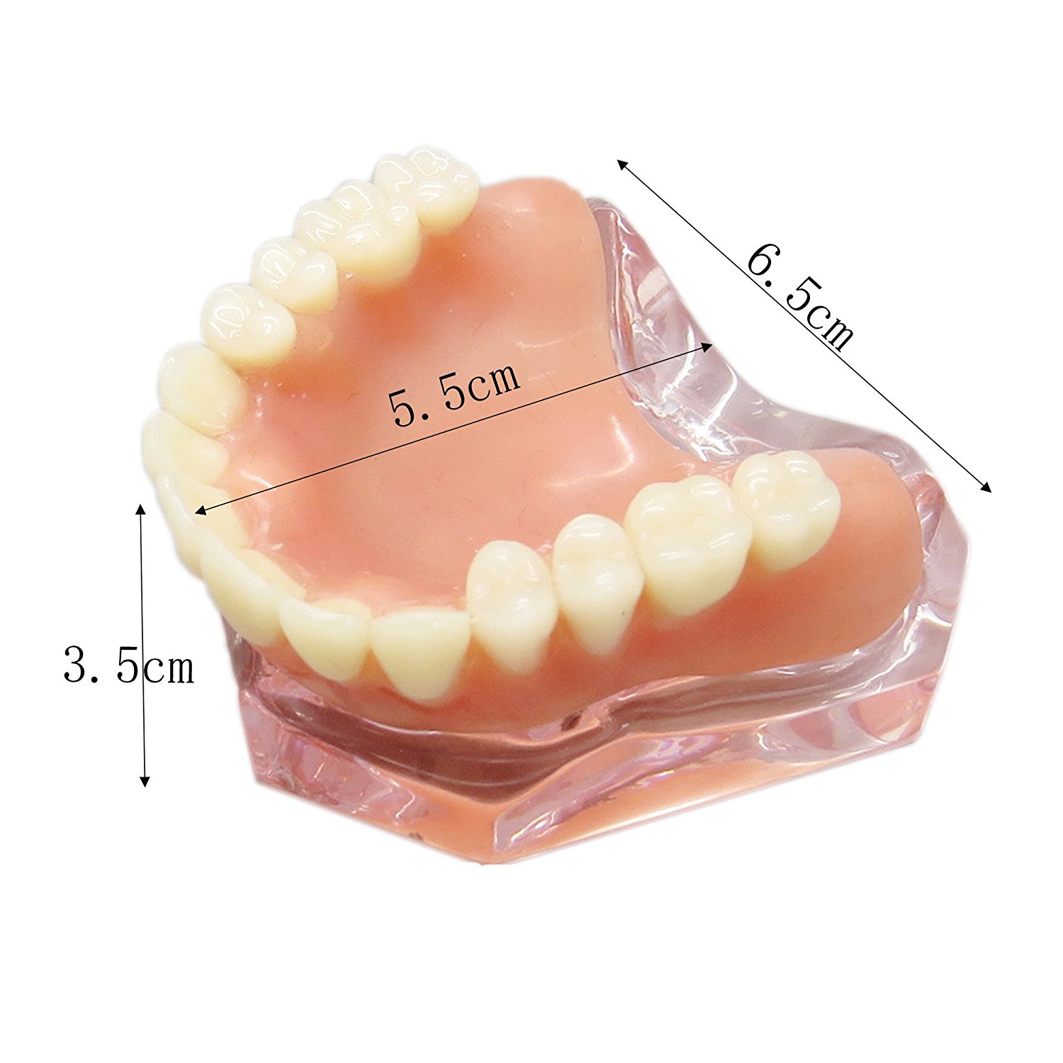 歯科上顎インプラントモデル模型 インプラント研究治療説明用歯列模型 4本釘 取り外し可能|歯科インプラント模型通販-Dentalshop.JP