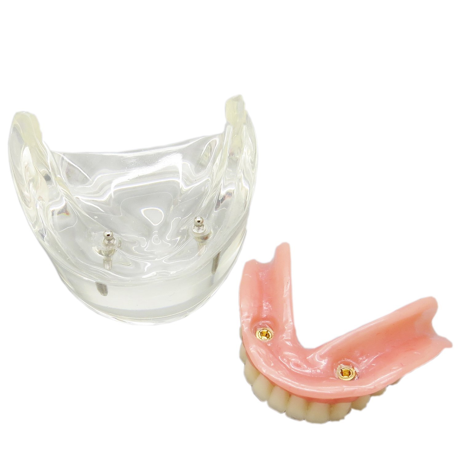 歯科下顎インプラントモデル模型 取り外し可能 高品質歯科インプラント研究治療説明用歯列模型 2本釘 透明 クリアベース|歯科インプラント模型 通販-Dentalshop.JP