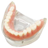 歯科下顎インプラントモデル模型 取り外し可能 高品質歯科インプラント研究治療説明用歯列模型 2本釘 透明 クリアベース