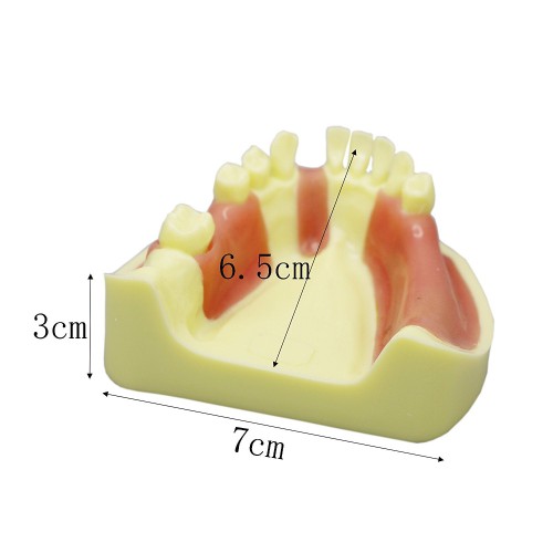 歯科下顎義歯模型 インプラント研究練習用道具 標準教学道具 イエローベース