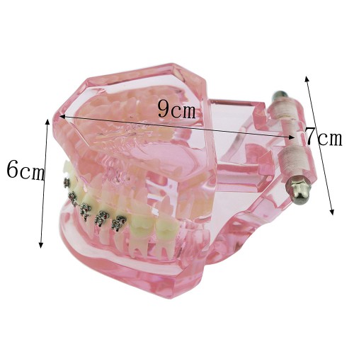 歯科上下顎治療説明用矯正模型 ブラケットモデル セラミック メタル ピンク