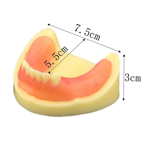 歯科練習用下顎義歯模型 歯科インプラント研究用標準教学道具 イエローベース