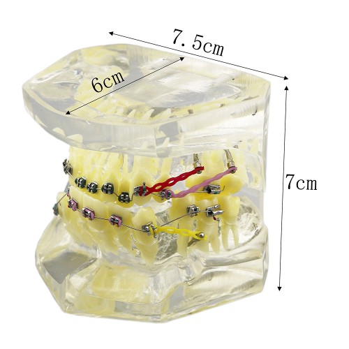歯科上下顎180度開閉式歯列矯正模型 矯正歯科治療用研究用 ブラケットモデル パワーチェーン装着