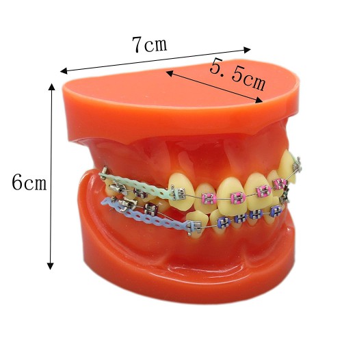 歯科上下顎180度開閉式歯列矯正模型 矯正歯科治療用研究用 ブラケットモデル パワーチェーン装着