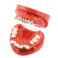 歯科上下顎180度開閉式歯列矯正模型 矯正歯科治療用研究用 ブラケットモデル パワーチェーン装着
