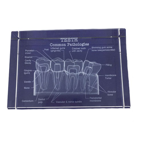 歯科水晶内部歯解剖図嵌め込み 歯科教学水晶置物歯科装飾品プレゼント