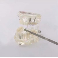 10本歯科精密20-70um 2.5-6mm歯科矯正IPRダイヤモンドストリップ医学砂片面