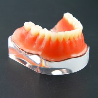 歯科下歯モデル 義歯模型 オーバーデンチャー 模型 精密インプラント ゴールデン下顎模型 教学用 歯模型 学習用 6009