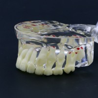 新しい歯科模型 歯列モデル 子供小児病理模型 教学 研究 説明用 4002