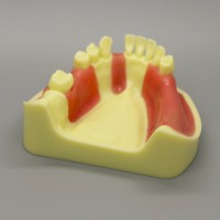 歯科模型 モデル 下顎インプラント練習モデル 歯肉付き #2004 01
