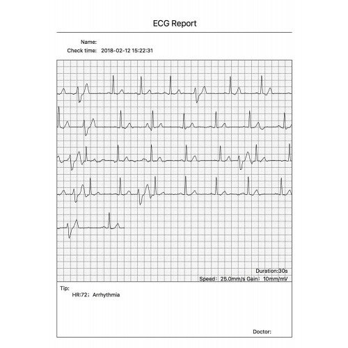 CONTEC ポータブル心電計 ECG/EKGモニター PCソフトウェア 心電図ブルートゥース心拍数LCDモニター PM10