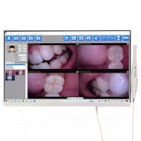 Magenta YF-2400P 歯科口腔内カメラ 24 インチ タッチスクリーン (WIFI 付き)