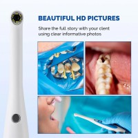 Magenta MD280 720P HD USB 歯科診断用口腔内カメラ(Windows 10/11対応)