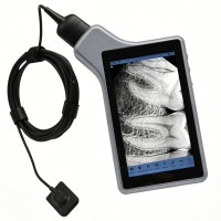 歯科用デジタルX線画像システム X-2006 RVGセンサー（5インチタブレットスクリーン付き）
