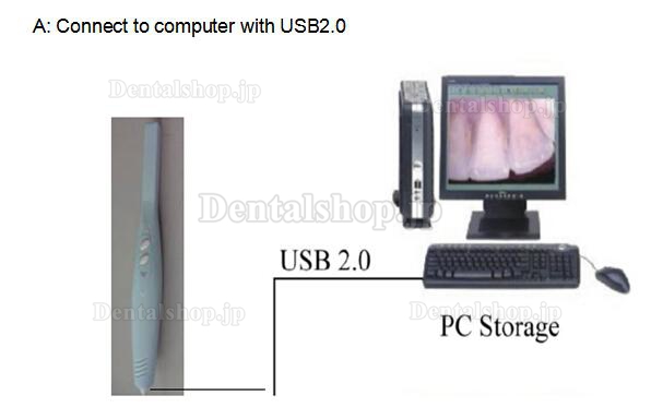 MLG® CF-688A歯科用口腔内カメラ (USB&OTG)