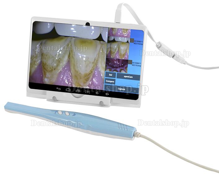 MLG® CF-688A歯科用口腔内カメラ (USB&OTG)