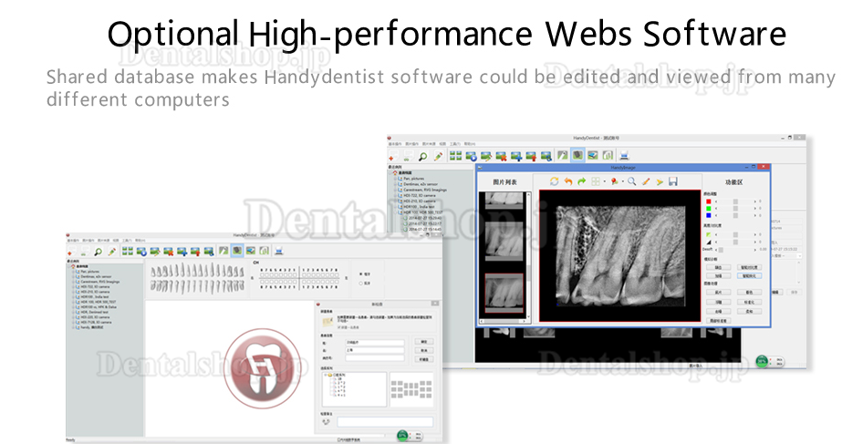 Handy® 歯科用デジタルX線センサー デンタルセンサー HDR 500