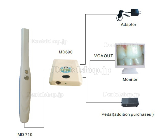 Magenta®歯科用·家庭用口腔内カメラMD710+MD690 有線タイプ