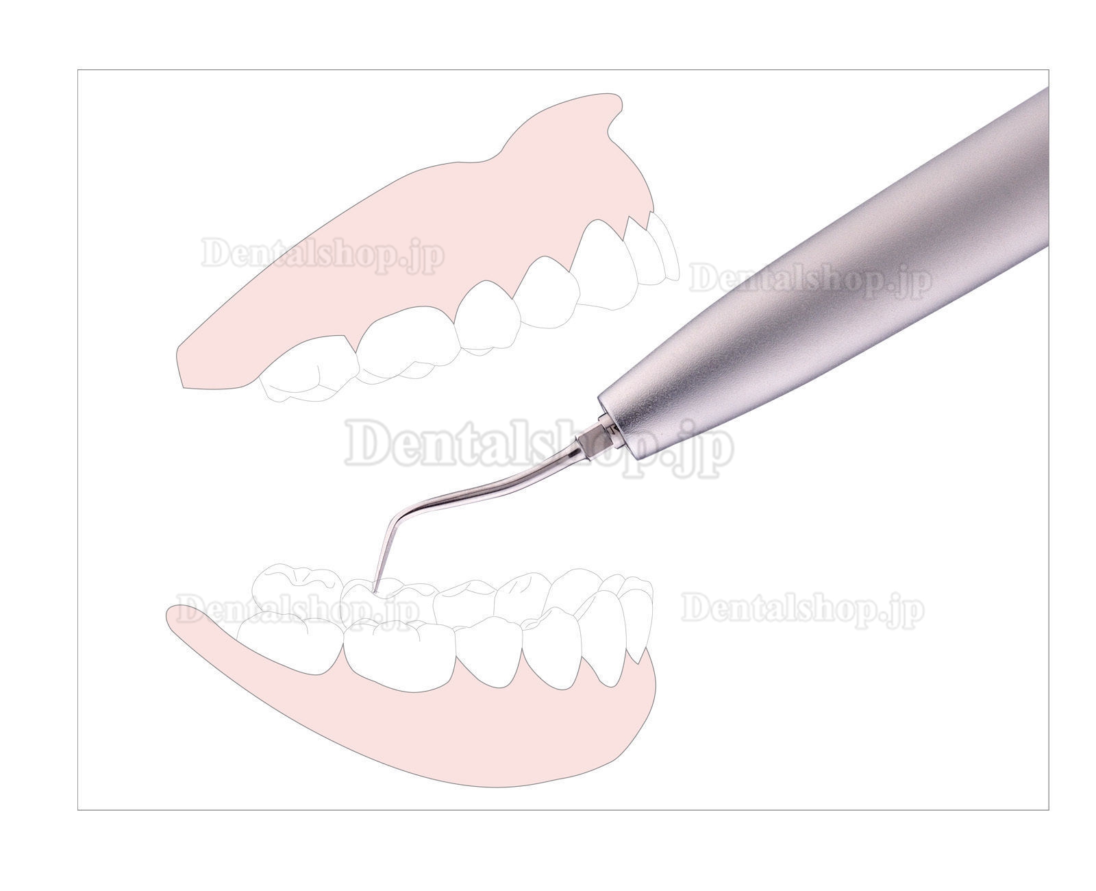 3H® Sonic SS-MF歯科用エアースケーラー-KaVo MULTlflex LUXカップリング対応without coupling