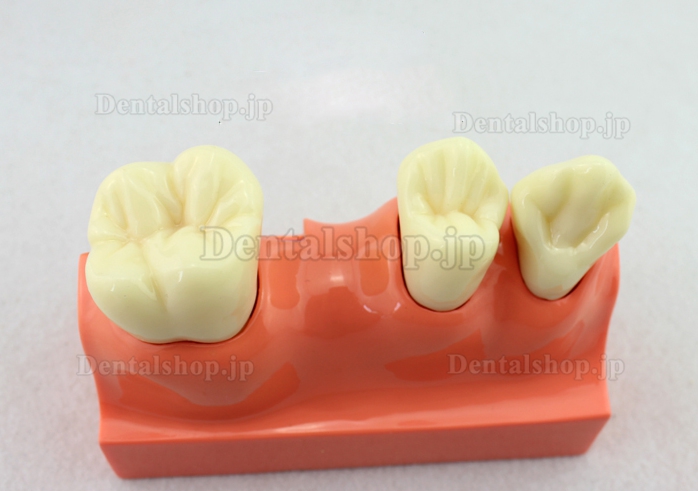 ENOVO®解剖学的歯模型