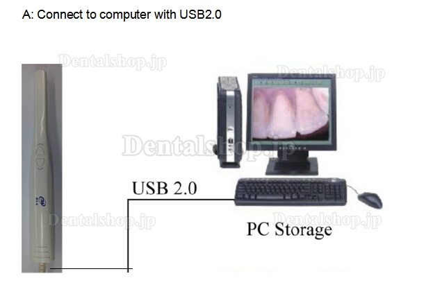 MLG®歯科用口腔内カメラCF-683A (USB&OTG&TV)