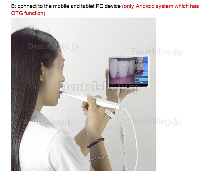 MLG®歯科用口腔内カメラCF-683A (USB&OTG&TV)