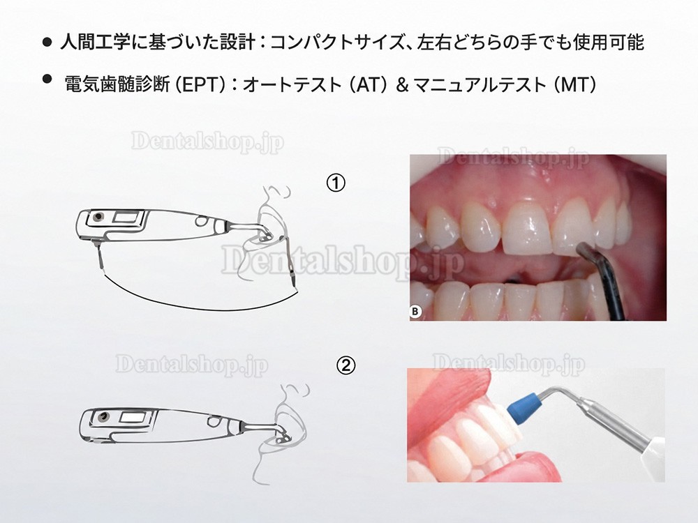 Denjoy Meta Pulp 電気と温熱歯髄診断器 Denjoy Meta Pulp 電気と温熱歯髄診断器