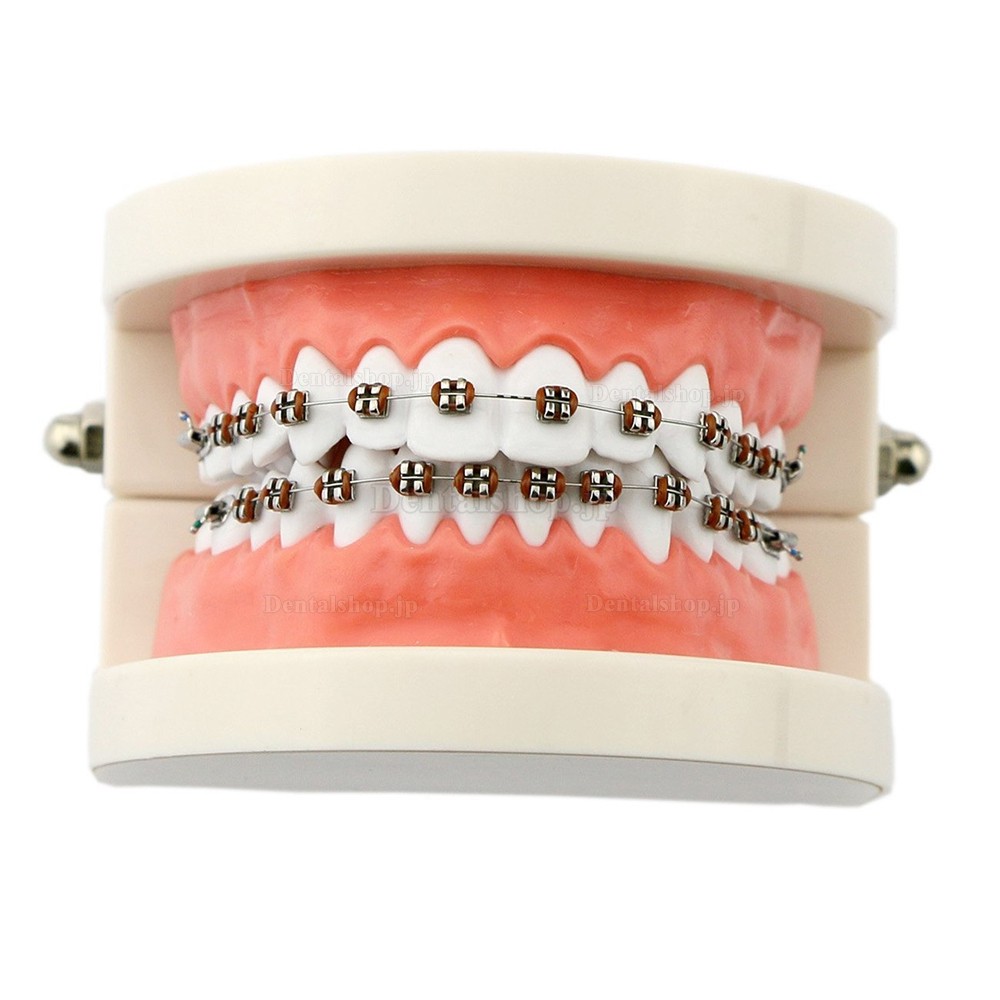 歯科矯正治療説明用メタルブラケット装置模型 180度開閉式上下額歯列模型 白