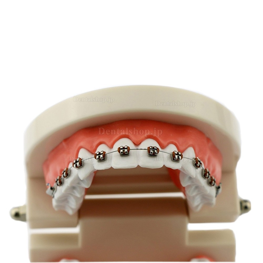 歯科矯正治療説明用メタルブラケット装置模型 180度開閉式上下額歯列模型 白