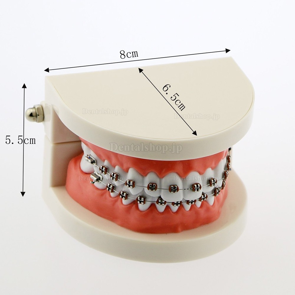 歯科矯正治療説明用メタルブラケット装置模型 180度開閉式上下額歯列模型 白