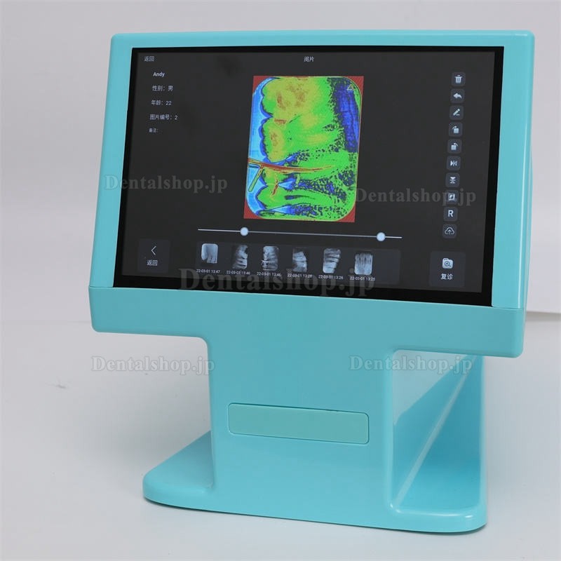 Dynamic DDT-100A 歯科用PSPスキャナー イメージングプレートスキャナー