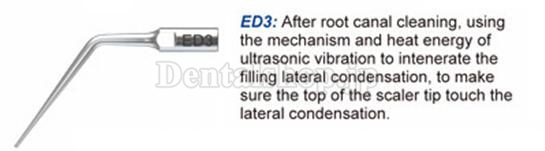 Woodpecker®根管治療用チップED3（DTE/SATELECと交換、5本入）