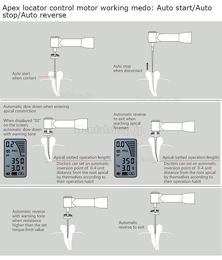 ワイヤレス根管モーター 歯科用根管治療機器 根管長測定器機能付き