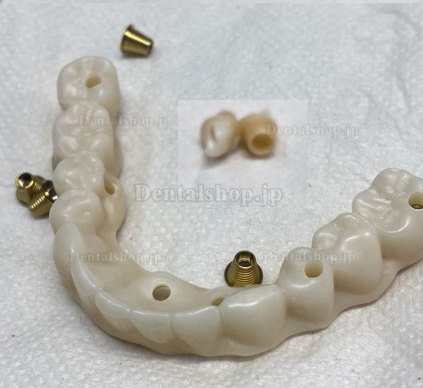 Kingch® 3D ProMax 98/95mm 歯科ジルコニアディスク CAD/CAMセラミックディスク