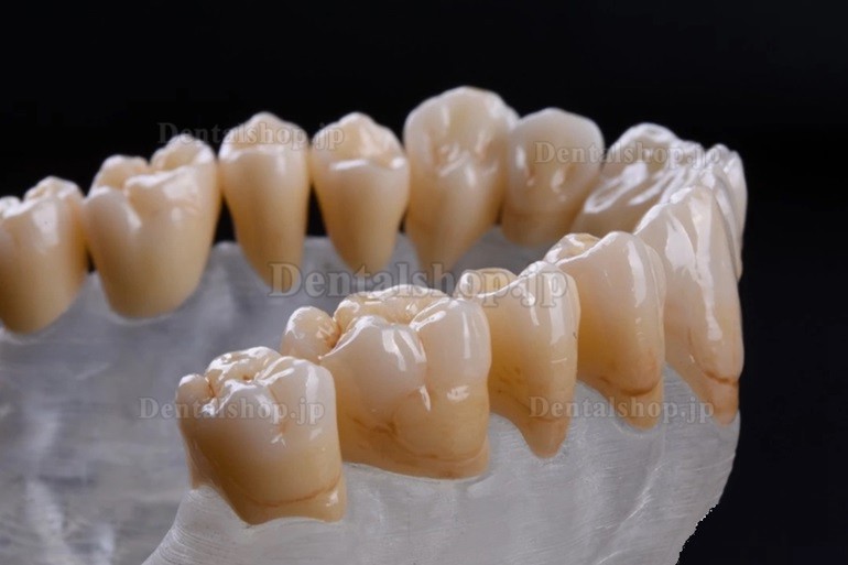 Kingch® 3D-M 98/95mm 歯科プレシェード多層 ジルコニアディスク CAD/CAMセラミックディスク