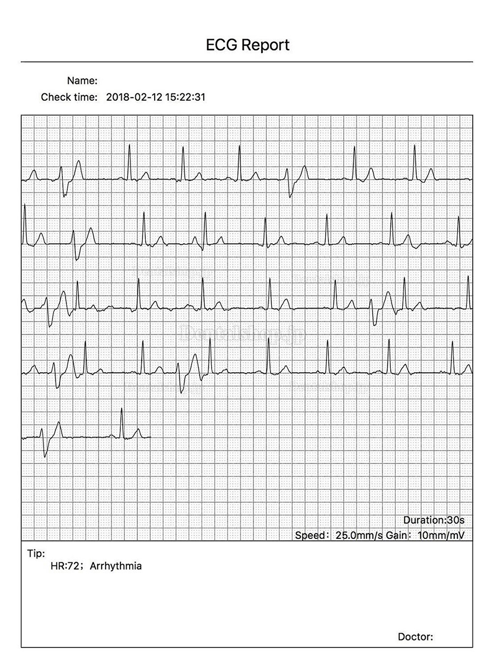 CONTEC ポータブル心電計 ECG/EKGモニター PCソフトウェア 心電図ブルートゥース心拍数LCDモニター PM10