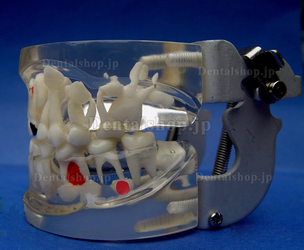 ENOVO®乳歯から永久歯に生え変わる時期の透明模型