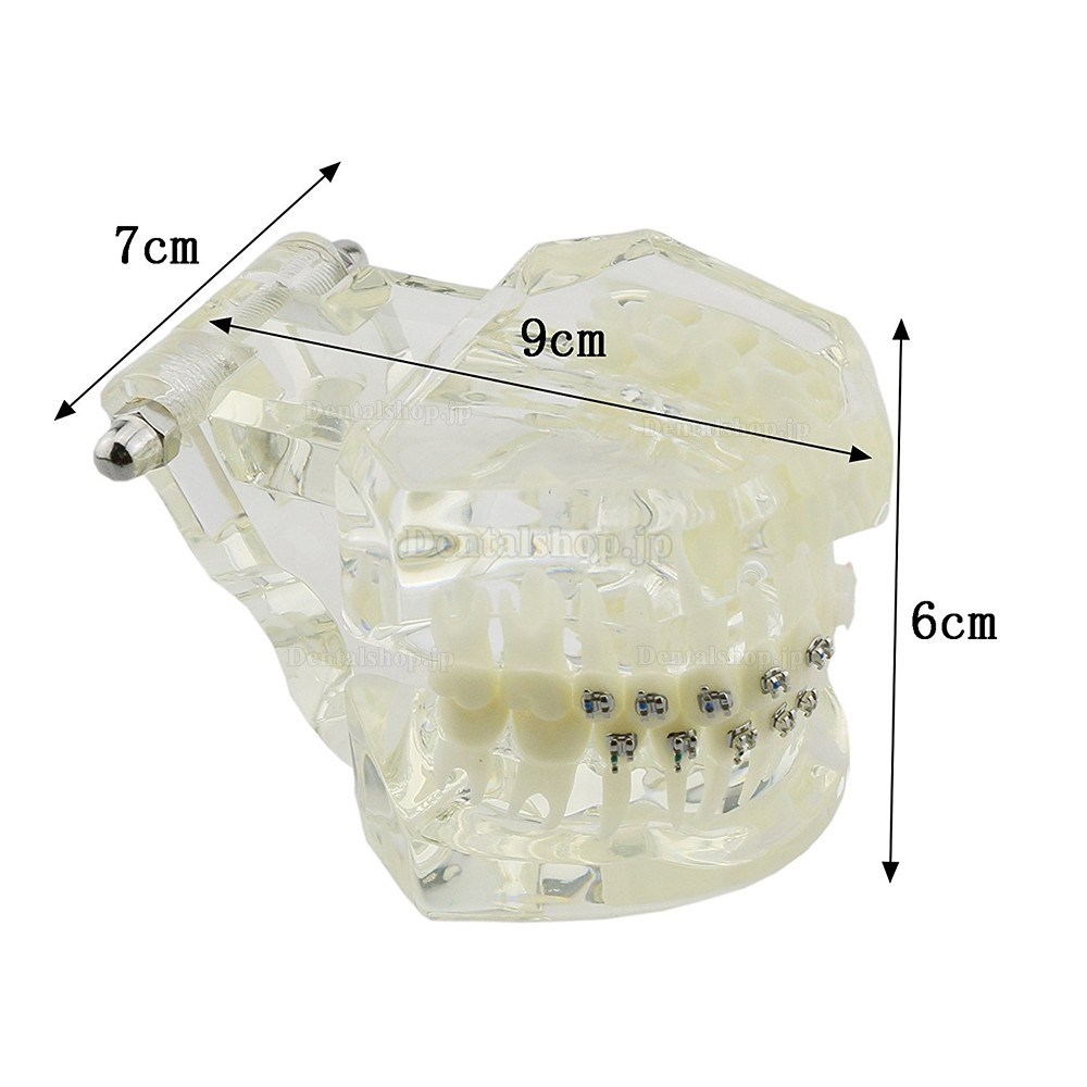 高品質歯列矯正治療説明用 ブラケットモデル セラミックメタル上下顎 模型 クリアベース