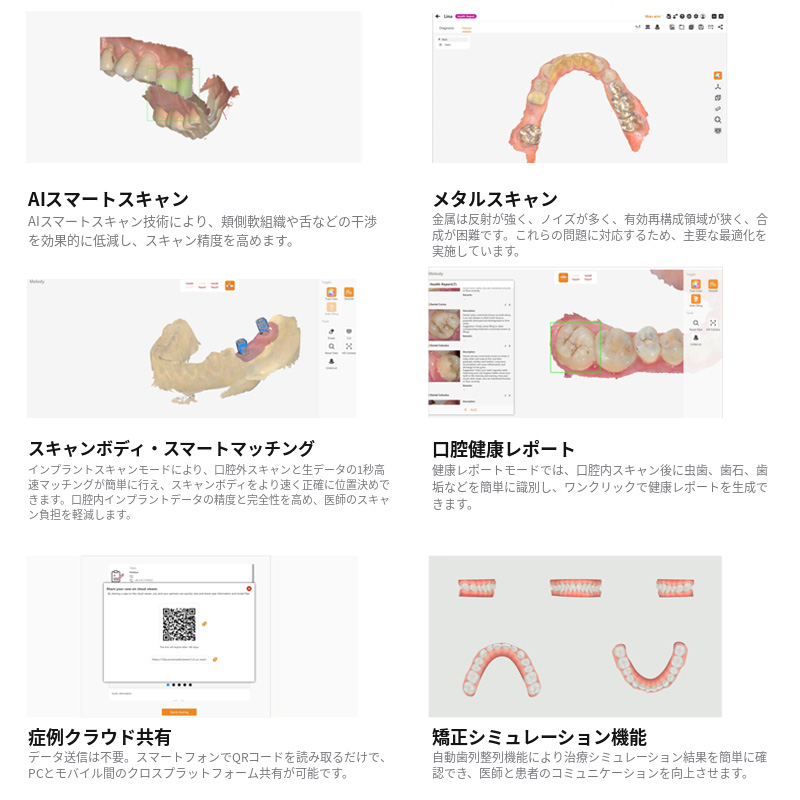 歯科用3D口腔内スキャナーM108 LED光源、パウダーフリー＆防曇