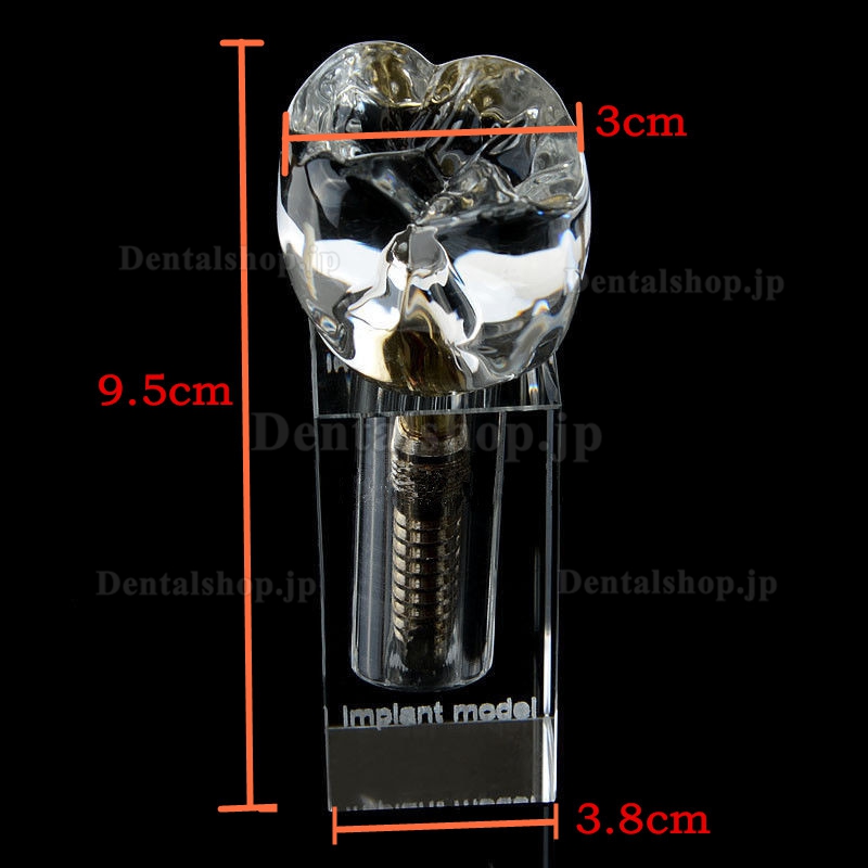 歯科インプラントM2019-II展示用透明模型